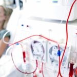 What happens while you are going to treat yourself under dialysis?