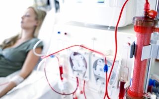 hemodialysis