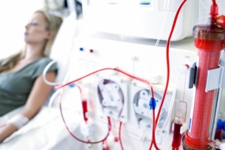 hemodialysis