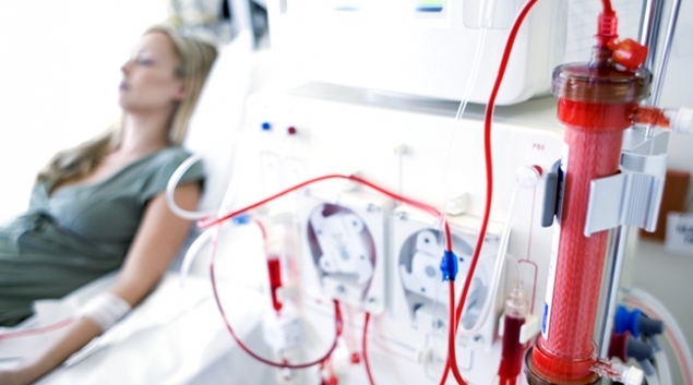 hemodialysis