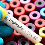 Legionella Testing Market