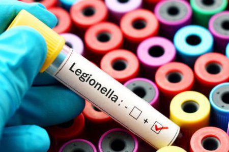 Legionella Testing Market